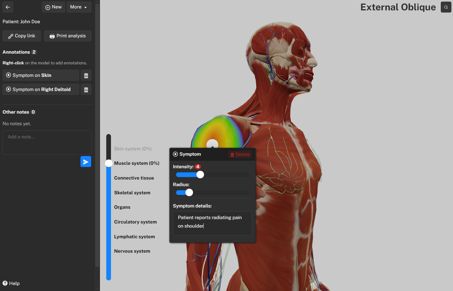 An example of annotating shoulder pain.